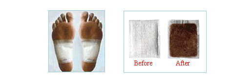 Silver Deyox Foot Pads before and after